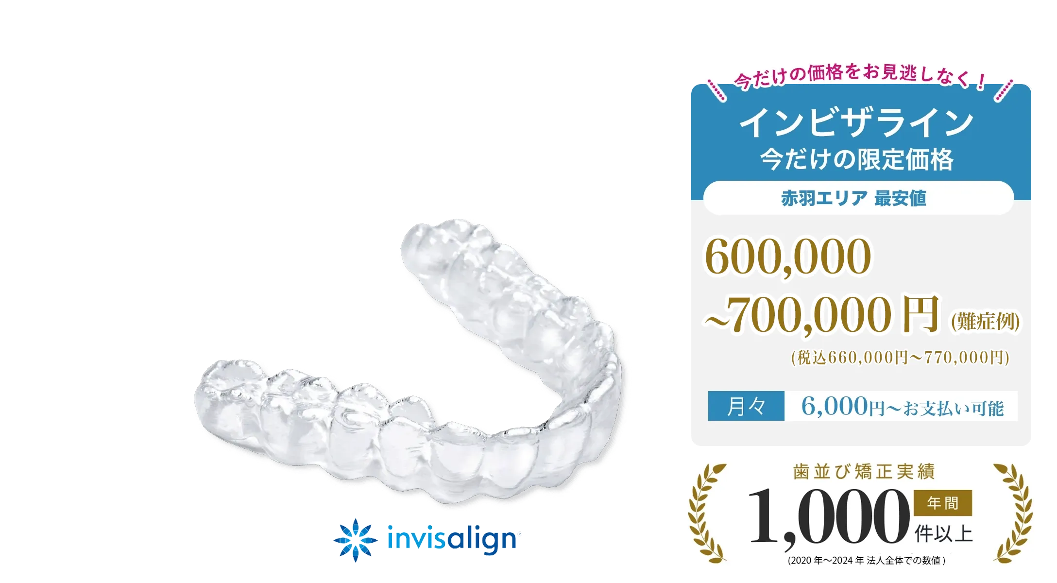 透明なマウスピース矯正（インビザライン）